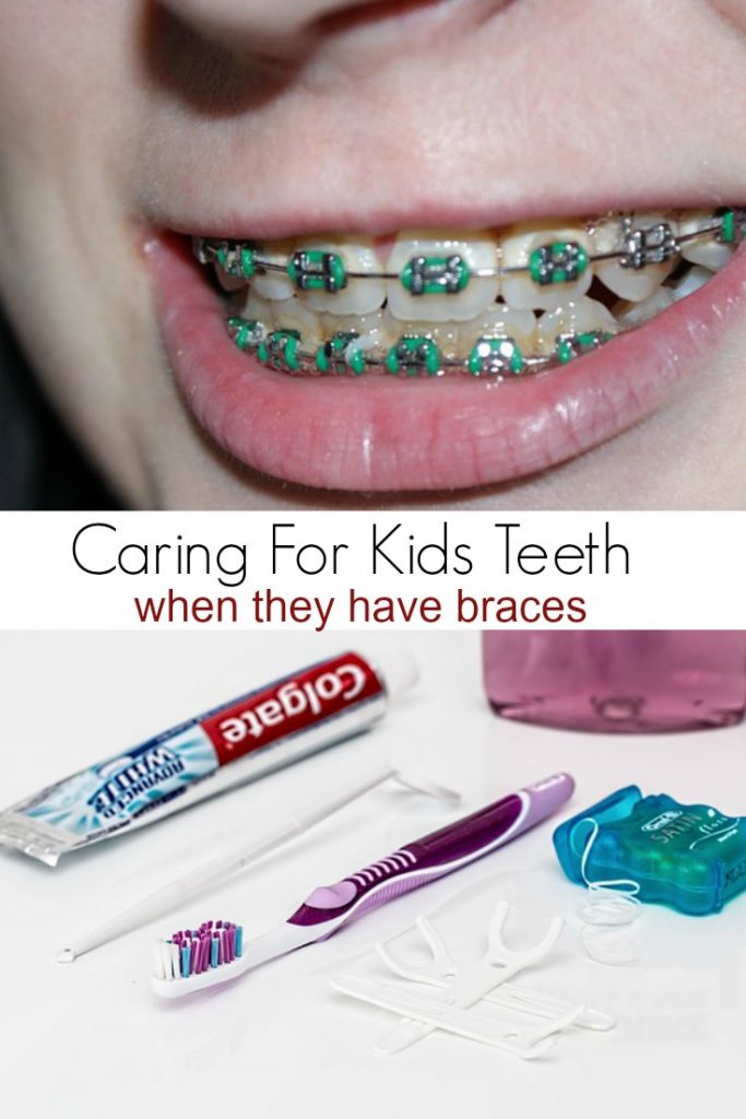 Caring for Kids Teeth when they have braces